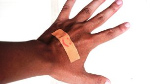 World-first 3D printed skin to help speed up